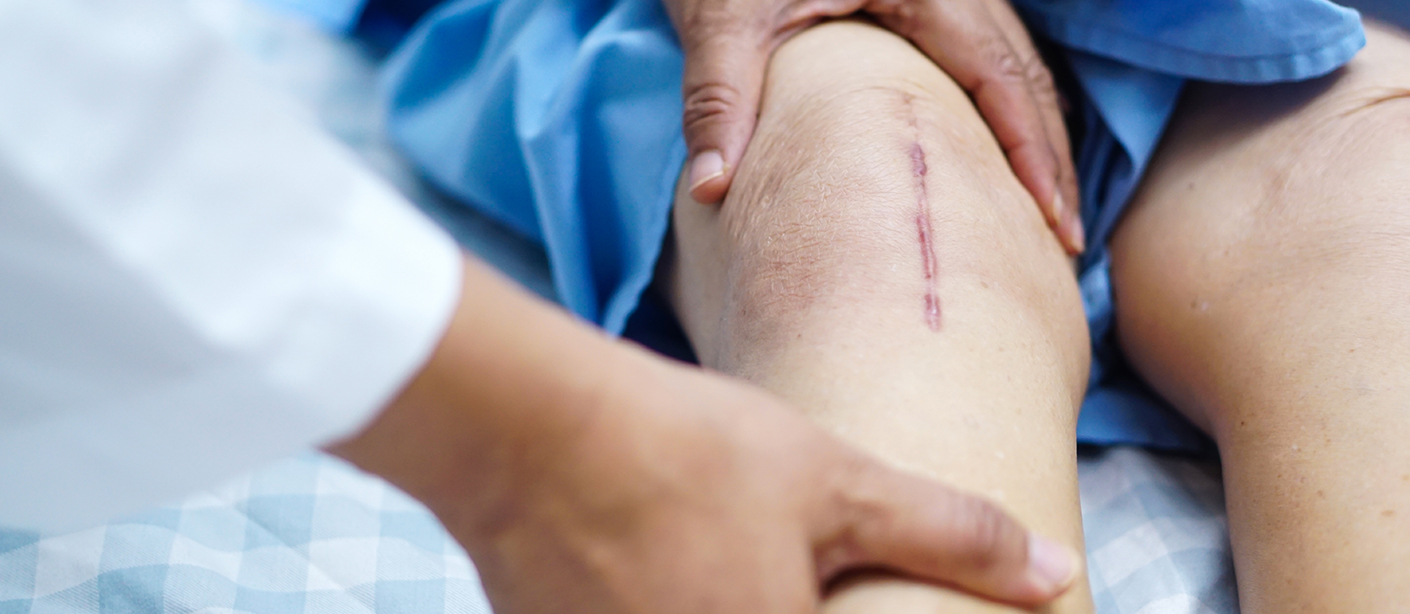 Providing Surgical Wound Care And Understanding the types of healing