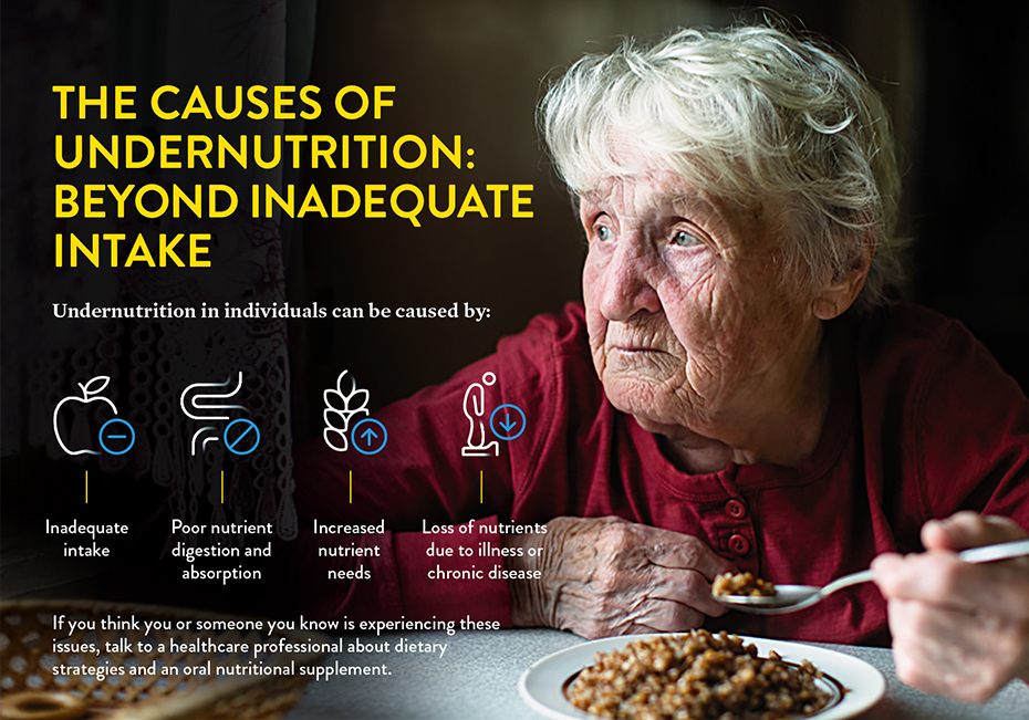 Micrographic titled "The Causes of Undernutrition: Beyond Inadequate Intake" describes four main causes of undernutrition in adults.